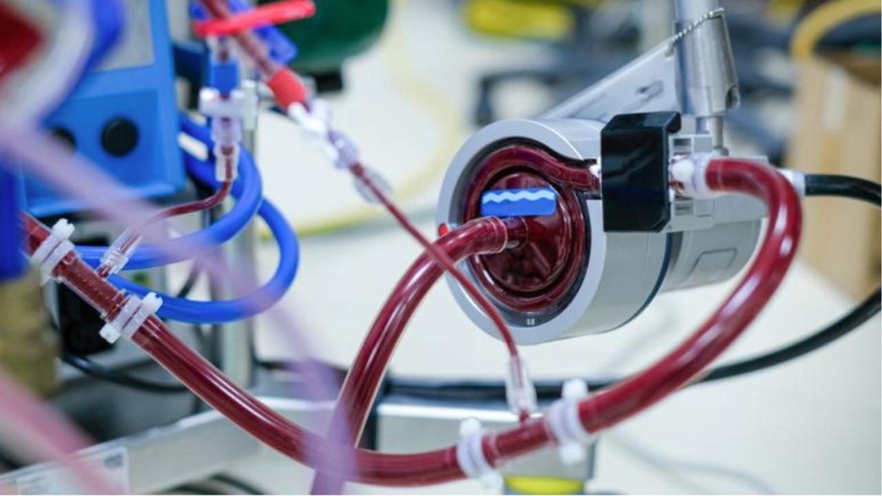Terapia ECMO